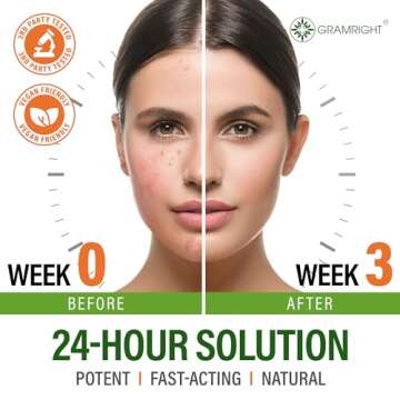 Acne Treatment Face Cream - Acne Spot Treatment for Face & Acne Dots - Tea Tree Oil for Acne - Natural Cystic Acne Treatment -Made in USA- For All Skin Types - Acne Scar Cream & Pimple Remover 4 fl.oz