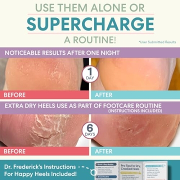 Dr. Frederick's Moisturizing Heel Socks for Cracked Heels