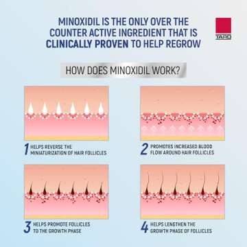 Taro Minoxidil Topical Aerosol Foam, 5%, Hair Regrowth 3 Months Treatment for Men, 2.11 oz (3 Pack)