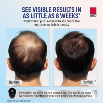 Taro Minoxidil Topical Aerosol Foam, 5%, Hair Regrowth 3 Months Treatment for Men, 2.11 oz (3 Pack)
