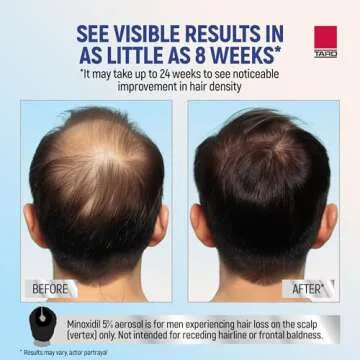 Taro Minoxidil Topical Aerosol Foam, 5%, Hair Regrowth 3 Months Treatment for Men, 2.11 oz (3 Pack)