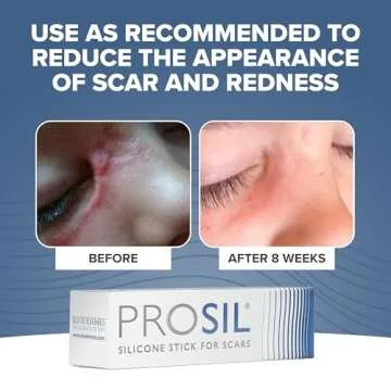 PROSIL Silicone Scar Stick 4.25g – Effective Scar Treatment with Premium-Grade Silicone – Compact, Mess-Free, Glide-on Application for Convenient Scar Therapy – Gentle on All Skin Types & Kids