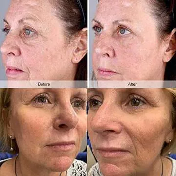 Red Light Therapy Lamp, ICANON Timing with 3 Switch Modes LED Infrared Light Therapy Device, 670nm Red and 850nm Infrared Light Combo Red Lights Bulb for Skin and Pain Relief with Remote and Stand