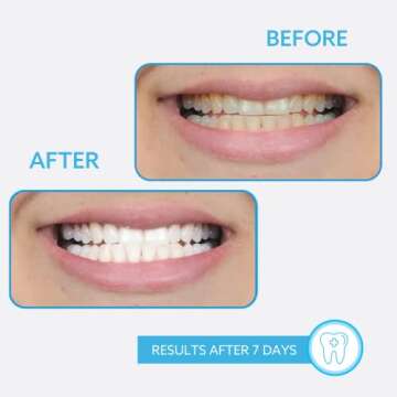 GO SMILE Extreme White 7 Day Teeth Whitening System