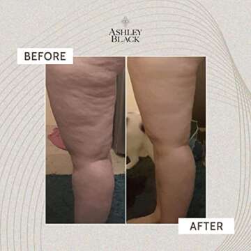 The Fascia Layers Kit by Ashley Black. Therapist and Doctor Endorsed Myo-Fascial Tools. The Face Blaster for Surface Tissue. The FasciaBlaster for Muscles. The Nugget for Deep Triggers