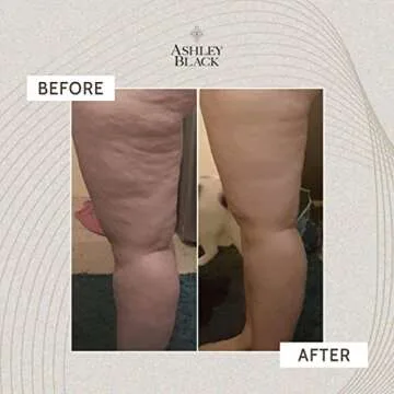 The Fascia Layers Kit by Ashley Black. Therapist and Doctor Endorsed Myo-Fascial Tools. The Face Blaster for Surface Tissue. The FasciaBlaster for Muscles. The Nugget for Deep Triggers