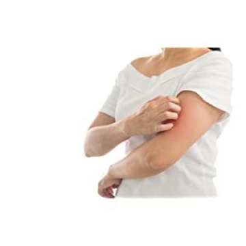 Globe Hydrocortisone Ointment 3 Pack for Itch Relief