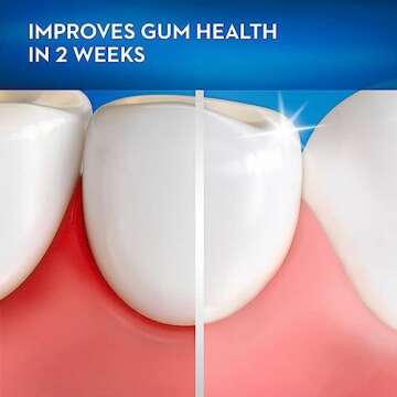 Oral-B Gum Care Sensitive Toothbrushes, Extra Soft, 2 Count