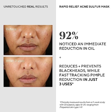 Murad Acne Sulfur Mask - Quick Relief for Breakouts