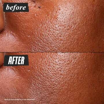 Kiehl's Ultra Pure High-Potency 5.0% Niacinamide Serum, Concentrated Face Serum for Oily Skin, Reduces Excess Oil and Shine, Helps Minimize Imperfections for a Natural Glow, Paraben-Free - 1 fl oz