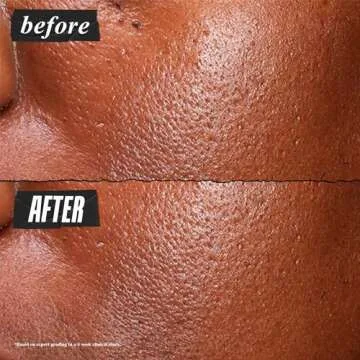 Kiehl's Ultra Pure High-Potency 5.0% Niacinamide Serum, Concentrated Face Serum for Oily Skin, Reduces Excess Oil and Shine, Helps Minimize Imperfections for a Natural Glow, Paraben-Free - 1 fl oz