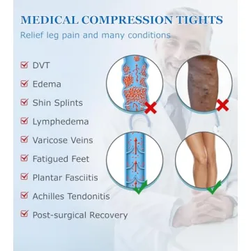 MGANG Medical Compression Pantyhose for Edema and Varicose Veins