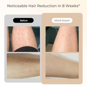 ARTOLF Laser Hair Removal Device for Home Use