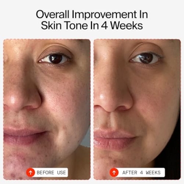 Youth To The People Vitamin C Skin Serum - Brightening Serum