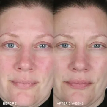 TATCHA Indigo Calming Cream 50ml for Skin Relief