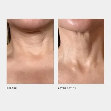 U Beauty The SCULPT Neck Cream for Youthful Skin