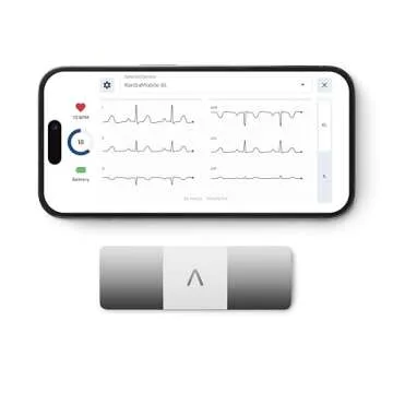 KardiaMobile Personal EKG Heart Rate Monitor – 6 Leads - Record EKGs at Home - Detect Irregular Heartbeats and Irregular Arrhythmias - Includes 1 Year Access - Works with Most Smartphones – AliveCor