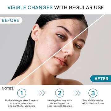 REMEDIAL PAX Scar Removal Cream for Women and Men - Rapid Repair of New Old Scars, Spots, Burns All Natural Treatment with Vitamin E, Alanine, Collagen