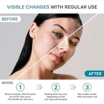 REMEDIAL PAX Scar Removal Cream for All Skin Types