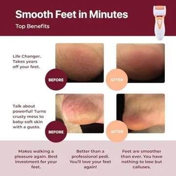 Rechargeable Callus Remover for Feet - Own Harmony