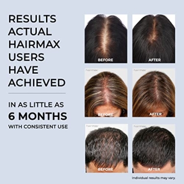 HairMax Hair Growth Device - Restores Natural Cycle