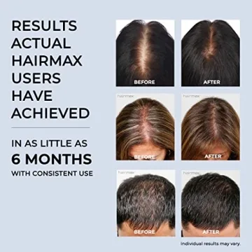 HairMax Hair Growth Device - Restores Natural Cycle