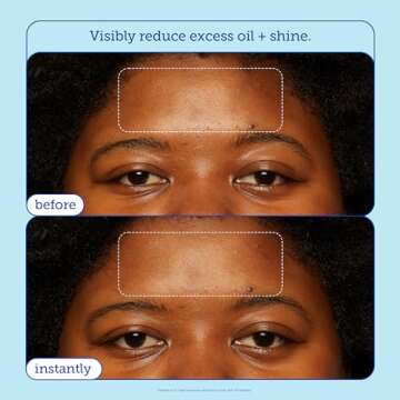 Skinfix Barrier+ Skin Barrier Restoring Gel Cream: Formulated with Niacinamide & Peptides, Ideal for Oily and Blemish-Prone Skin, Restores Skin Barrier, 1.7 oz