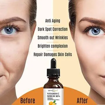 DERMAXGEN 30% Vitamin C Serum for Face, Hyaluronic Acid + Vitamin (B3 + E) + Jojoba + Aloe Vera- Natural & Organic Anti Wrinkle & Skin Rejuvenator Moisturizer Vitamin C for All Skin - (4 FL OZ)