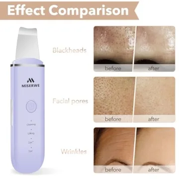 Deep Cleansing Skin Scrubber Spa Tool for Facial Care