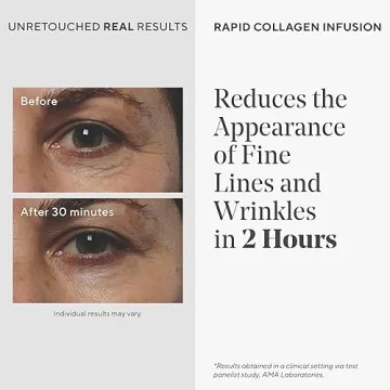 Murad Rapid Collagen Infusion - Youthful Skin Solution