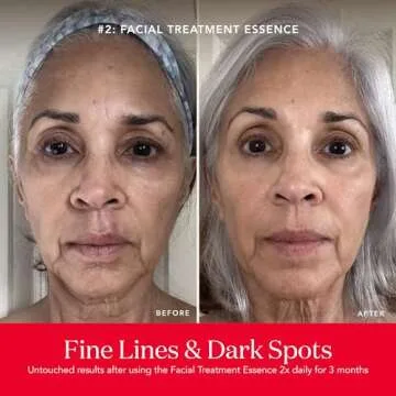 SK-II Youth Essentials Skin Care Set for Radiant Skin