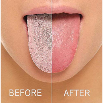 SUAVEC Liphontcta Colorful Tongue Cleaners for Healthy Smiles