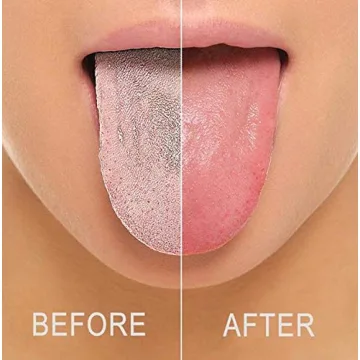 SUAVEC Liphontcta Colorful Tongue Cleaners for Healthy Smiles