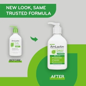 AmLactin Daily Moisturizing Lotion 12% Lactic Acid Exfoliator