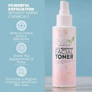Witch Hazel Toner for Face - Facial Toner for Dry Skin - Skin Toner for Women - Toner for Acne Prone...