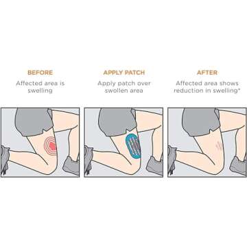 KT Tape Recovery+ Patch, Swelling and Inflamation Relieft