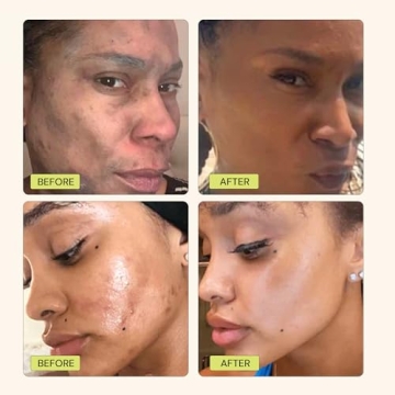 Gleamin Vitamin C Clay Mask for Radiant Skin