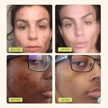 Gleamin Vitamin C Clay Mask for Radiant Skin