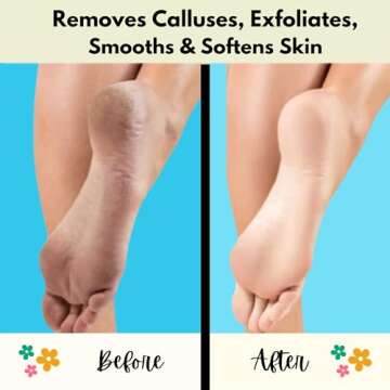 Mr. Pumice Callus Remover PUMI Bar: Pedicure Stone & Foot/Heel Scrubber - Medium Grit (Assorted Colo...