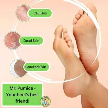 Mr. Pumice Callus Remover for Smooth Feet 4-Pack