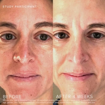 Rodan + Fields Redefine Regimen | Complete Skincare Gift Set