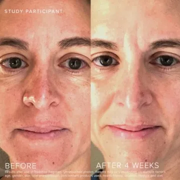 Rodan + Fields Redefine Regimen | Complete Skincare Gift Set