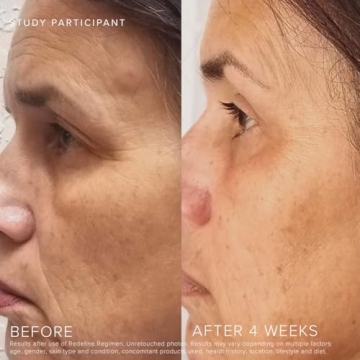 Rodan + Fields Redefine Regimen | Complete Skincare Gift Set