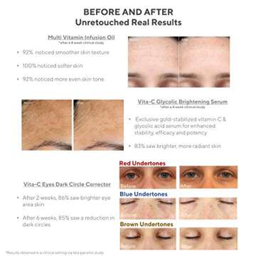 Murad 30 Day Rapid Brightening Kit - 5-Piece Set