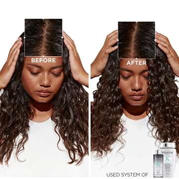 Kerastase Symbiose Anti Dandruff Shampoo | Nourishing Blend