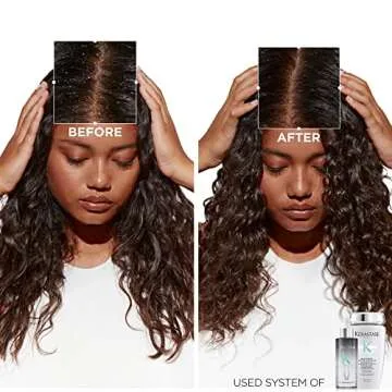 Kerastase Symbiose Anti Dandruff Shampoo | Nourishing Blend