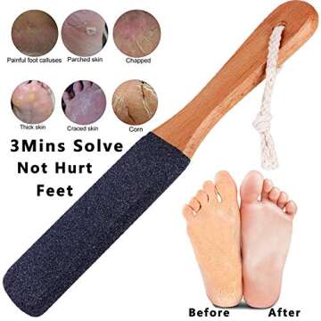 Kinepi Foot File Callus Remover Foot Scrubber,Professional Pedicure Foot Rasp Removes Cracked Heels,...