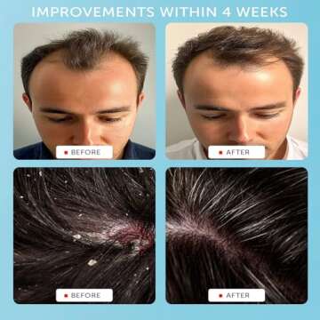 Sent From Earth Vegan Dandruff Treatment Shampoo - Natural Formula