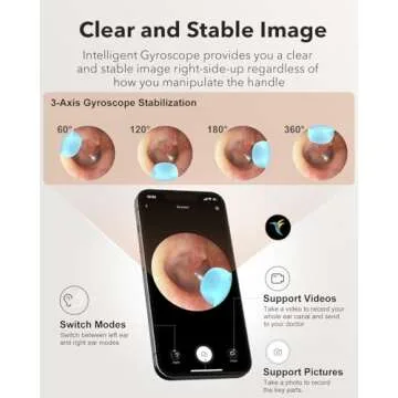 Bebird M9 Ear Care Wax Removal Tool Camera Cleaning Kit- Wireless Cleaner Ear Viewing Scope OTO-Scope with Camera & Light - Video Earpick with 10 Replacement Tips and 3 Check Attachemnts