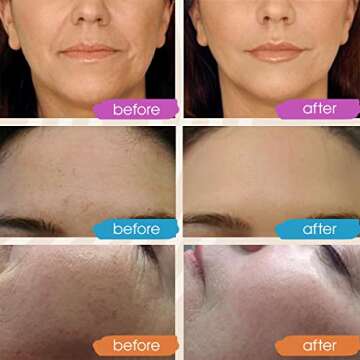 GLEOW Vitamin C Face Serum, Hydrating Vitamin C Serum for Face with Hyaluronic Acid, Suitable For All Skin Types, Targets the Appearance of Dull Spots 2oz